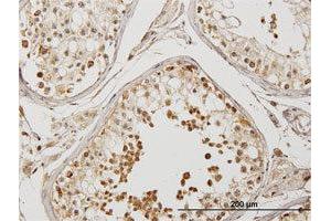 Immunoperoxidase of purified MaxPab antibody to DYX1C1 on formalin-fixed paraffin-embedded human testis. (DYX1C1 anticorps  (AA 1-381))