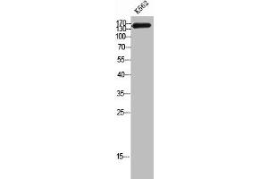 Western Blot analysis of K562 cells using CAF-1 p150 Polyclonal Antibody (CHAF1A anticorps  (Internal Region))