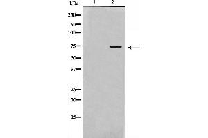 Western blot analysis on HeLa cell lysate using IL-2Rbeta/CD122 Antibody. (IL2 Receptor beta anticorps  (Internal Region))