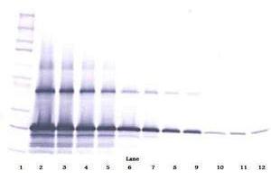 Image no. 1 for anti-WNT1 Inducible Signaling Pathway Protein 2 (WISP2) antibody (ABIN465385) (WISP2 anticorps)
