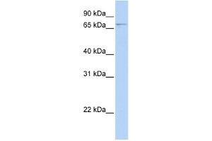 WB Suggested Anti-GLMN Antibody Titration: 0. (GLMN anticorps  (N-Term))