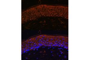 Immunofluorescence analysis of Mouse skin using  Rabbit pAb (ABIN6134303, ABIN6136434, ABIN6136435 and ABIN6216449) at dilution of 1:100. (CXCR7 anticorps  (AA 50-150))