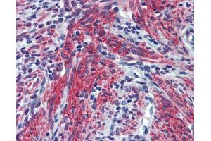 Anti-POSTN / Periostin antibody IHC staining of human uterus.