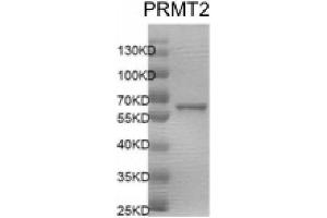 Recombinant PRMT2 protein gel.