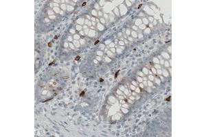 Immunohistochemical staining (Formalin-fixed paraffin-embedded sections) of human colon with KIT monoclonal antibody, clone CL1667  shows strong immunoreactivity in some lymphoid cells. (KIT anticorps  (AA 50-190))