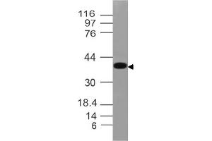 Image no. 1 for anti-N-Myc Downstream Regulated 1 (NDRG1) (AA 123-318) antibody (ABIN5027495) (NDRG1 anticorps  (AA 123-318))