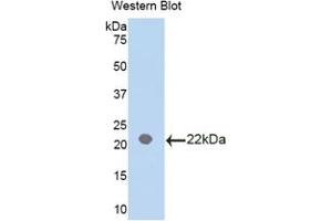 Western blot analysis of the recombinant protein. (IL18BP anticorps  (AA 29-193))