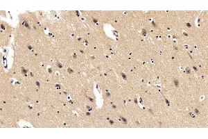 Detection of PDGF BB in Porcine Cerebrum Tissue using Polyclonal Antibody to Platelet Derived Growth Factor BB (PDGF BB) (PDGF-BB Homodimer (AA 82-190) anticorps)