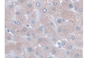 Detection of AST in Human Liver Tissue using Monoclonal Antibody to Aspartate Aminotransferase (AST)