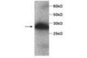 Image no. 1 for anti-serpin Peptidase Inhibitor, Clade B (Ovalbumin), Member 4 (SERPINB4) antibody (ABIN791515) (SERPINB4 anticorps)