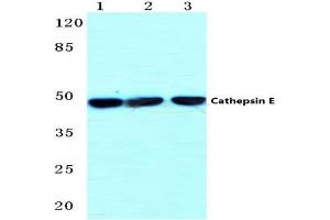 Western blot (WB) analysis of Cathepsin E antibody  at 1/500 dilution. (Cathepsin E anticorps)