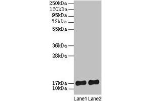 Western blot All lanes: SRP19 antibody at 2 μg/mL Lane 1: Jurkat whole cell lysate Lane 2: Hela whole cell lysate Secondary Goat polyclonal to rabbit lgG at 1/15000 dilution Predicted band size: 17, 13, 9 kDa Observed band size: 17 kDa