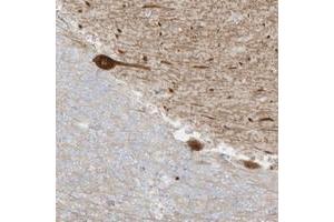 Immunohistochemical staining of human cerebellum with C11orf87 polyclonal antibody  shows strong cytoplasmic positivity in Purkinje cells. (C11ORF87 anticorps)