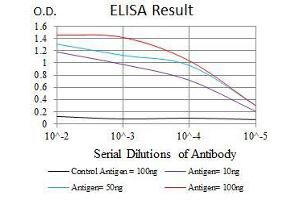 Black line: Control Antigen (100 ng), Purple line: Antigen(10 ng), Blue line: Antigen (50 ng), Red line: Antigen (100 ng),