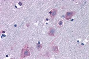 ABIN184974 (6. (TRIM2 anticorps  (C-Term))