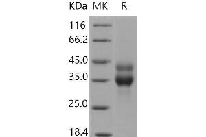 Cathepsin B (CTSB) (Active) protein (His tag)