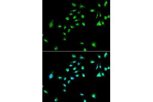 Immunofluorescence analysis of A549 cell using RAF1 antibody. (RAF1 anticorps  (AA 190-350))