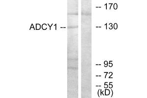 Western blot analysis of extracts from COLO205 cells, using ADCY1 antibody. (ADCY1 anticorps  (Internal Region))