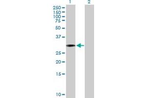 Western Blot analysis of SCML1 expression in transfected 293T cell line by SCML1 MaxPab polyclonal antibody. (SCML1 anticorps  (AA 1-208))