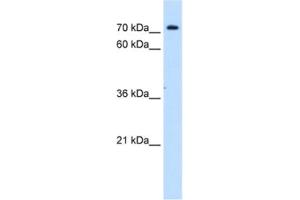 Western Blotting (WB) image for anti-Solute Carrier Family 5 (Sodium/inositol Cotransporter), Member 11 (SLC5A11) antibody (ABIN2462773) (Solute Carrier Family 5 (Sodium/inositol Cotransporter), Member 11 (SLC5A11) anticorps)