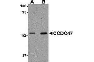 Western blot analysis of CCDC47 in mouse heart tissue lysate with AP30211PU-N CCDC47 antibody at (A) 1 and (B) 2 μg/ml. (CCDC47 anticorps  (C-Term))