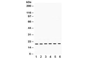 Western blot testing of 1) rat skeletal muscle, 2) rat thymus, 3) mouse brain, 4) mouse thymus, 5) human 22RV1, and 6) human MCF7 lysate with PTP4A2 antibody. (PTP4A2 anticorps)