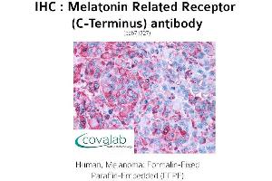 Image no. 1 for anti-G Protein-Coupled Receptor 50 (GPR50) (C-Term) antibody (ABIN1736883)