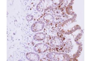 IHC-P Image Immunohistochemical analysis of paraffin-embedded human normal colon, using RPL15, antibody at 1:500 dilution.