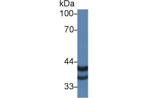 Western blot analysis of Human A375 cell lysate, using Human PSG2 Antibody (1 µg/ml) and HRP-conjugated Goat Anti-Rabbit antibody ( (PSG2 anticorps  (AA 35-335))
