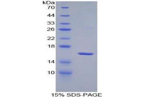 SDS-PAGE analysis of Mouse IL18R1 Protein. (IL18R1 Protéine)