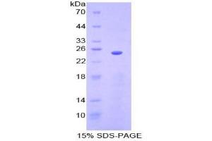 SDS-PAGE analysis of Mouse Sprouty Homolog 3 Protein. (SPRY3 Protéine)