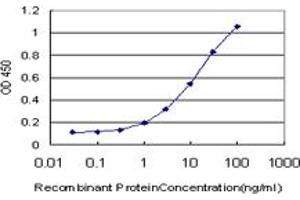 Detection limit for recombinant GST tagged LIMK1 is approximately 0.