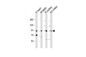 All lanes : Anti-PDE1C Antibody (Center) at 1:1000-2000 dilution Lane 1: human heart lysate Lane 2: mouse testis lysate Lane 3: rat kidney lysate Lane 4: NCI- whole cell lysate Lysates/proteins at 20 μg per lane. (PDE1C anticorps  (AA 375-409))