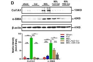 Calcipotriol alleviates BDL-induced liver injury and fibrosis. (COL1A1 anticorps  (AA 100-200))