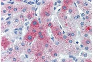 Human Liver (formalin-fixed, paraffin-embedded) stained with C6 antibody ABIN461987 at 10 ug/ml followed by biotinylated anti-mouse IgG secondary antibody ABIN481714, alkaline phosphatase-streptavidin and chromogen.