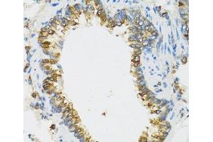 Immunohistochemistry of paraffin-embedded Rat lung using PI3 Polyclonal Antibody at dilution of 1:100 (40x lens). (PI3 anticorps)