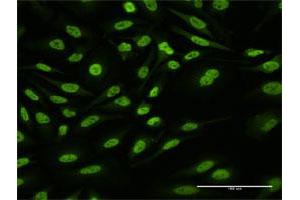 Immunofluorescence of purified MaxPab antibody to HNRNPUL1 on HeLa cell.