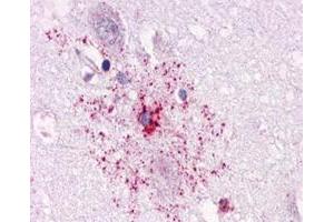 Immunohistochemical staining of formalin-fixed, paraffin-embedded human brain, astrocyte tissue after heat-induced antigen retrieval. (Apelin Receptor anticorps  (1st Cytoplasmic Domain))