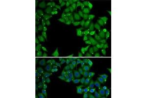 Immunofluorescence analysis of MCF7 cells using RTKN Polyclonal Antibody (Rhotekin anticorps)