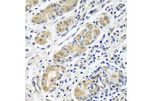 Immunohistochemistry of paraffin-embedded human stomach using GPRC5A antibody (ABIN5974510) at dilution of 1/100 (40x lens). (GPRC5A anticorps)