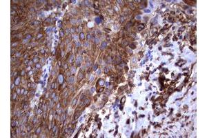 Image no. 5 for anti-Tumor Necrosis Factor Receptor Superfamily, Member 8 (TNFRSF8) (AA 19-379) antibody (ABIN1491084)