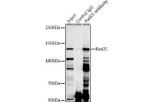 Immunoprecipitation analysis of 300 μg extracts of Jurkat cells using 3 μg Rad21 antibody (ABIN7269822). (RAD21 anticorps)