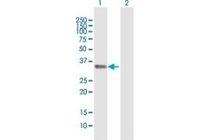 Western Blot analysis of STX11 expression in transfected 293T cell line by STX11 MaxPab polyclonal antibody. (Syntaxin 11 anticorps  (AA 1-287))