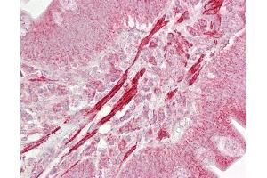 Anti-ROCK2 antibody IHC of human small intestine. (ROCK2 anticorps  (AA 511-560))