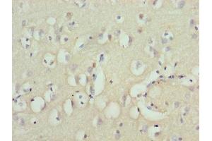 Immunohistochemistry of paraffin-embedded human brain tissue using ABIN7176132 at dilution of 1:100 (ZNF177 anticorps  (AA 1-321))