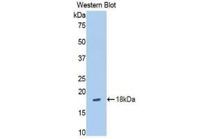 Western blot analysis of the recombinant protein. (SLIT3 anticorps  (AA 35-119))