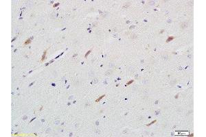 Formalin-fixed and paraffin embedded rat brain tissue labeled with Rabbit Anti-Neuroligin 1 Polyclonal Antibody  at 1:200 followed by conjugation to the secondary antibody and DAB staining.