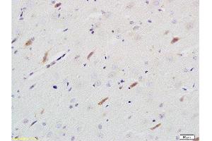 Formalin-fixed and paraffin embedded rat brain tissue labeled with Rabbit Anti-Neuroligin 1 Polyclonal Antibody  at 1:200 followed by conjugation to the secondary antibody and DAB staining. (Neuroligin 1 anticorps  (AA 701-800))