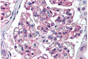 Human Kidney (formalin-fixed, paraffin-embedded) stained with PTK2B antibody ABIN239840 at 1:50 followed by biotinylated goat anti-rabbit IgG secondary antibody ABIN481713, alkaline phosphatase-streptavidin and chromogen. (PTK2B anticorps  (N-Term))