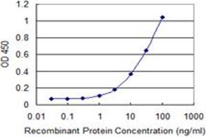 Detection limit for recombinant GST tagged STIM1 is 0. (STIM1 anticorps  (AA 24-685))